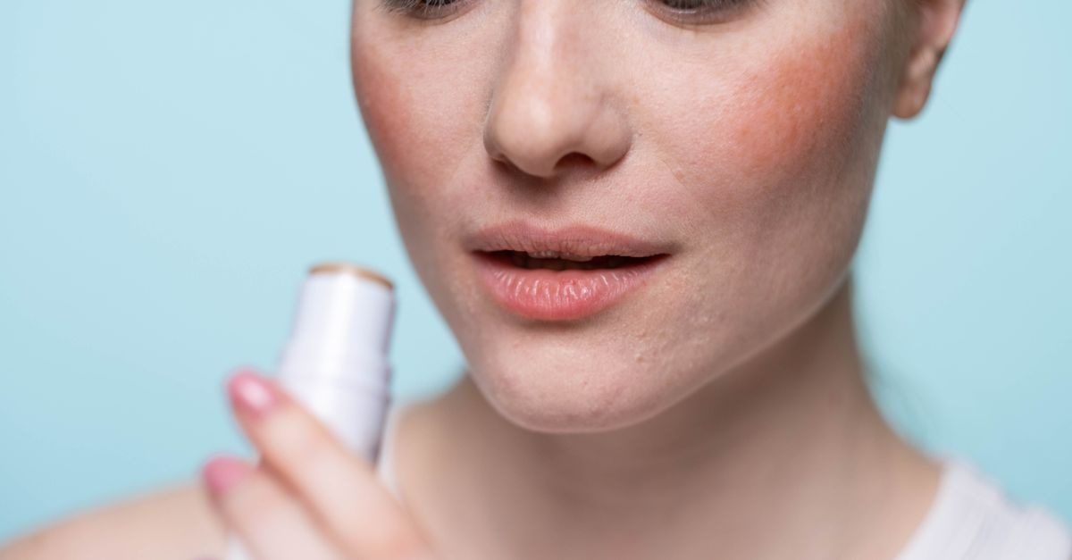 Eczema sul viso: come scegliere i cosmetici giusti per calmare la pelle e ridurre i rossori